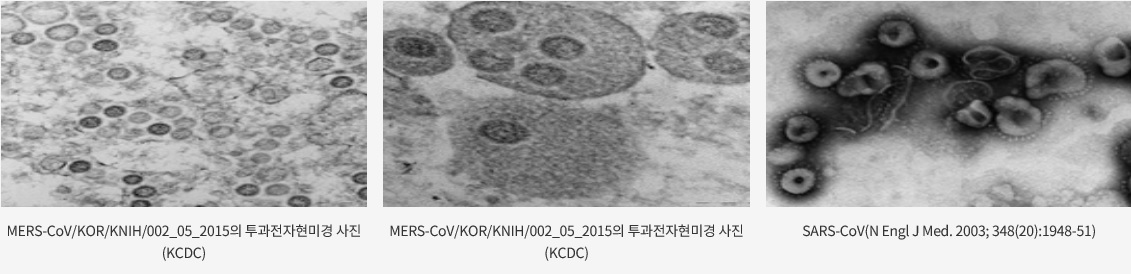 코로나 바이러스를 전자 현미경으로 관찰한 사진. (제공=질병관리본부)